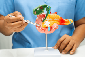 Gut and Oral Microbiome Dysbiosis in Pancreatic Cancer: Implications for Early Detection