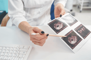 Groundbreaking Study Highlights Benefits of Early Pregnancy Scans in Detecting Fetal Anomalies
