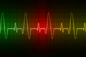 FDA Approves CARDAMYST™: A First-of-Its-Kind Nasal Spray for Adult PSVT Patients