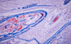 Engineered Human Cartilage–Derived Acellular Grafts for Immunomodulated Skeletal Healing