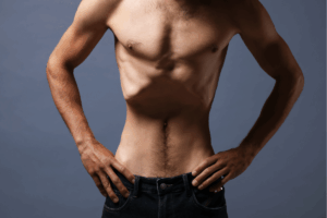 Skeletal Muscle Dysfunction and Dysregulated Protein Signaling After Anorexia Nervosa and Weight Restoration